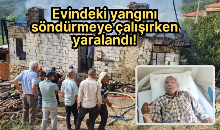 Evindeki yangını söndürmeye çalışırken yaralandı!