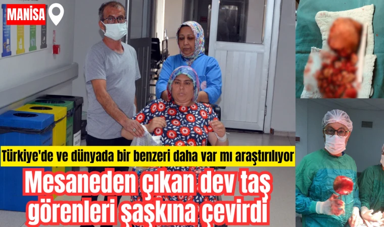 Mesaneden çıkan dev taş görenleri şaşkına çevirdi