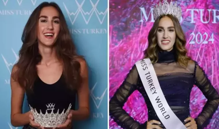 Miss Turkey güzelinin son halini görenler "Estetik yaptırmış" demekten kendini alamadı